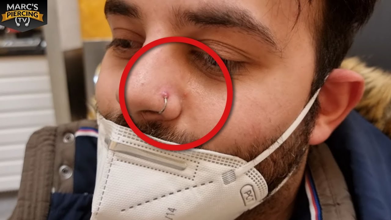 Piercing FAIL: voll entzündetes Nasenpiercing .💉 Marc's Piercing TV - Piercing Notfall / Wildfleisch