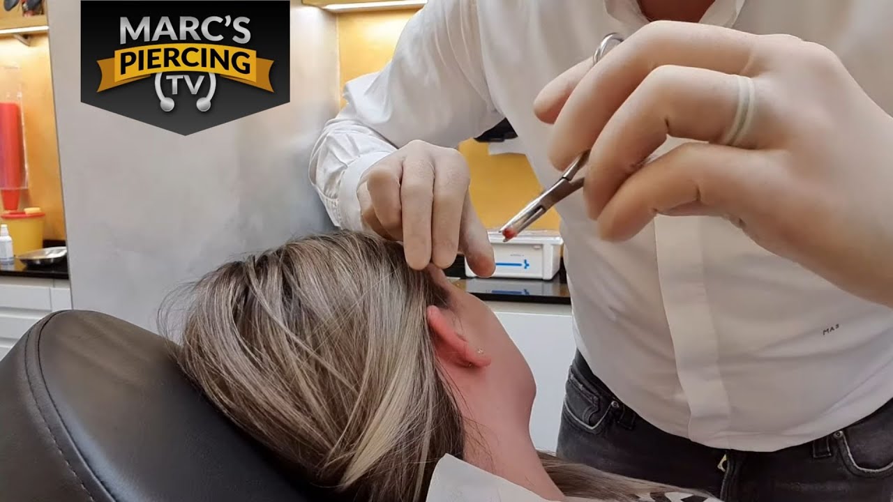 Piercing FAILS: Eingewachsenes geschossenes Ohrloch💉 Marc schneidet mit Skalpell 💉Marc's Piercing TV