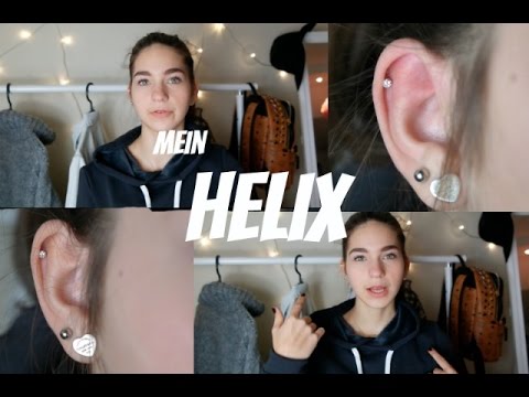 Mein HELIX I Schmerzen, Kosten, Nachbehandlung...