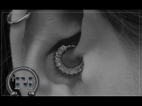 Piercing stechen - Daith Piercing - oft als Migränepiercing verkauft und gepierct